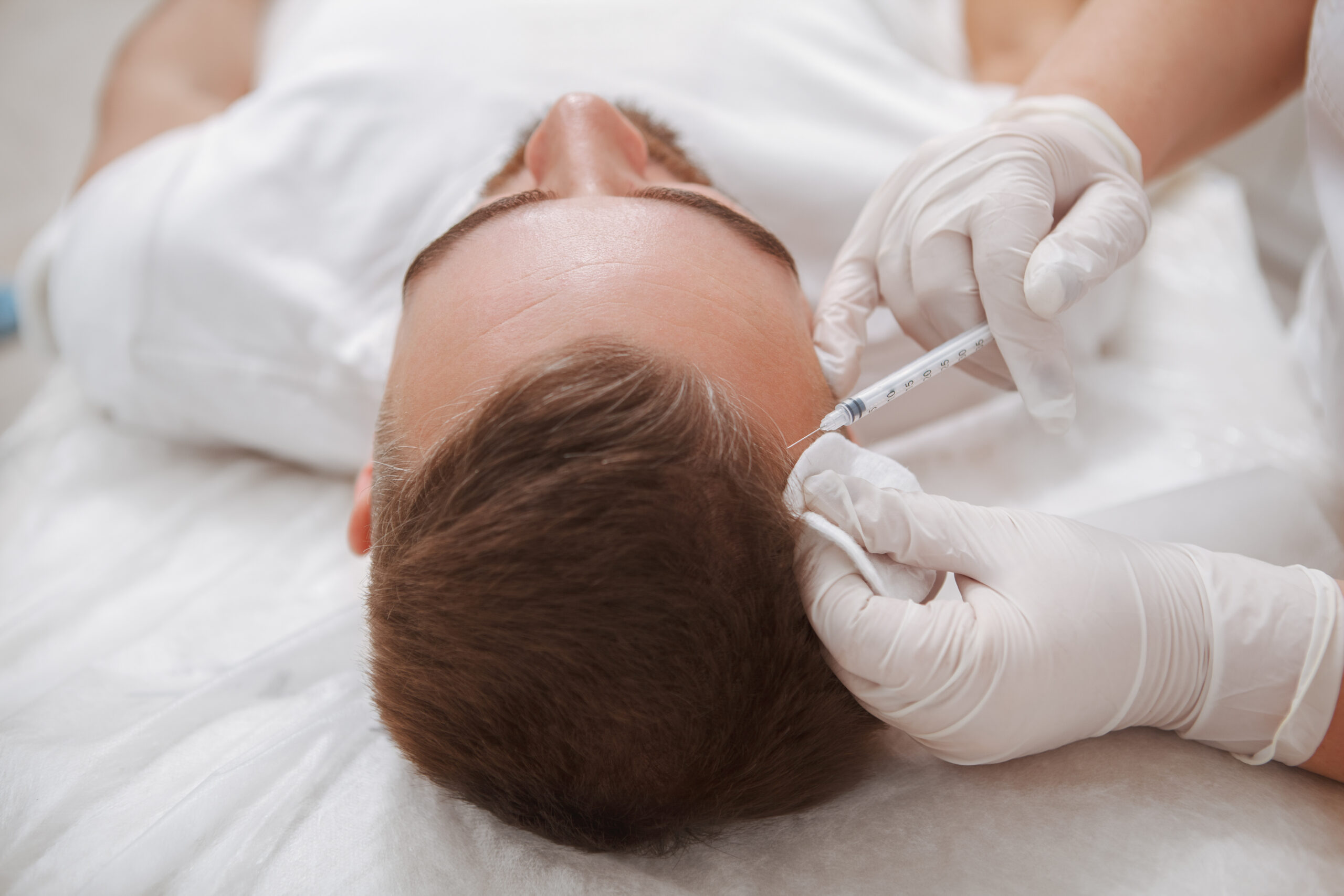 Man receiving injections to the scalp to promote hair regrowth